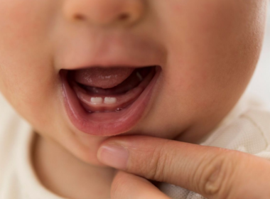 Bebeklerde Diş Çıkarma Süreci ve Belirtileri